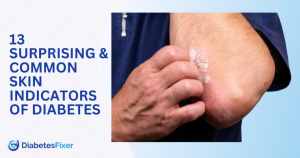 13 Skin Symptoms That Can Signal Diabetes