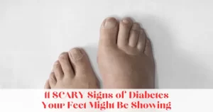 11 SCARY Signs of Diabetes Your Feet Might Be Showing